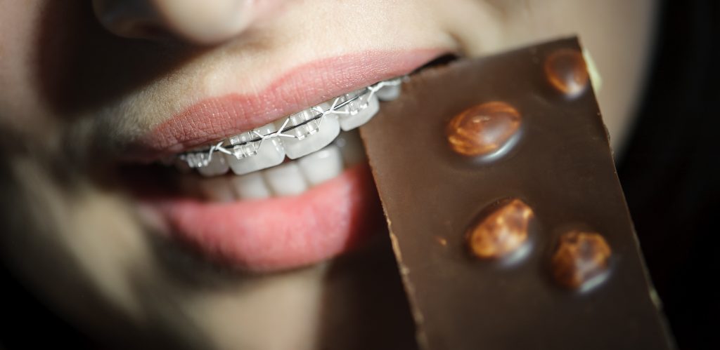 foods to avoid with braces