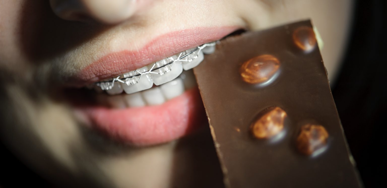 Foods to Avoid with Braces Bubble Children's Dentistry and Orthodontics